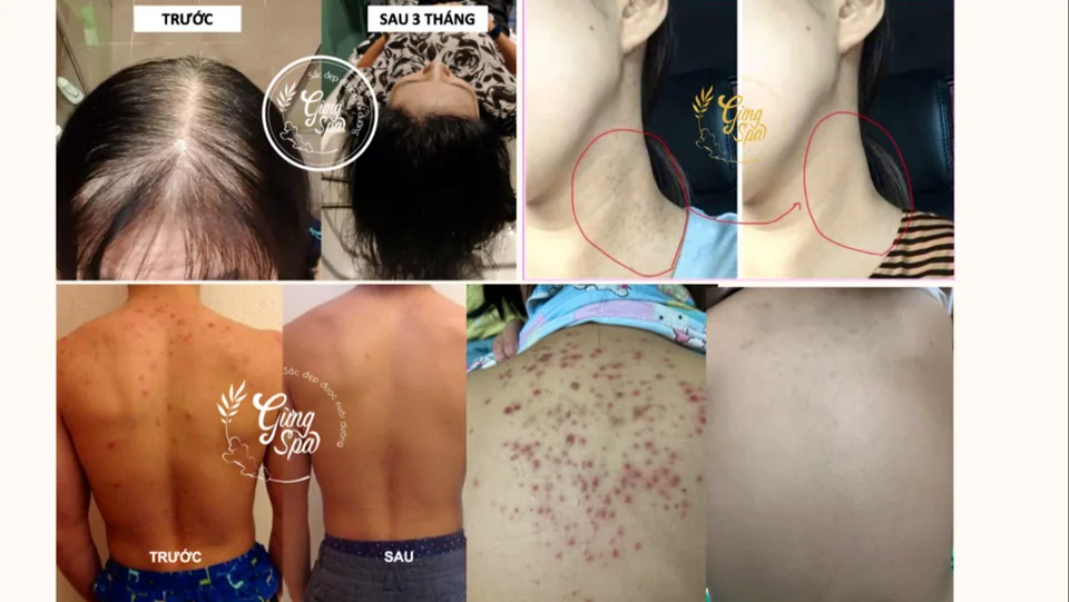 Phòng trị liệu yên tĩnh, tone ấm dành cho khách massage cổ vai gáy.